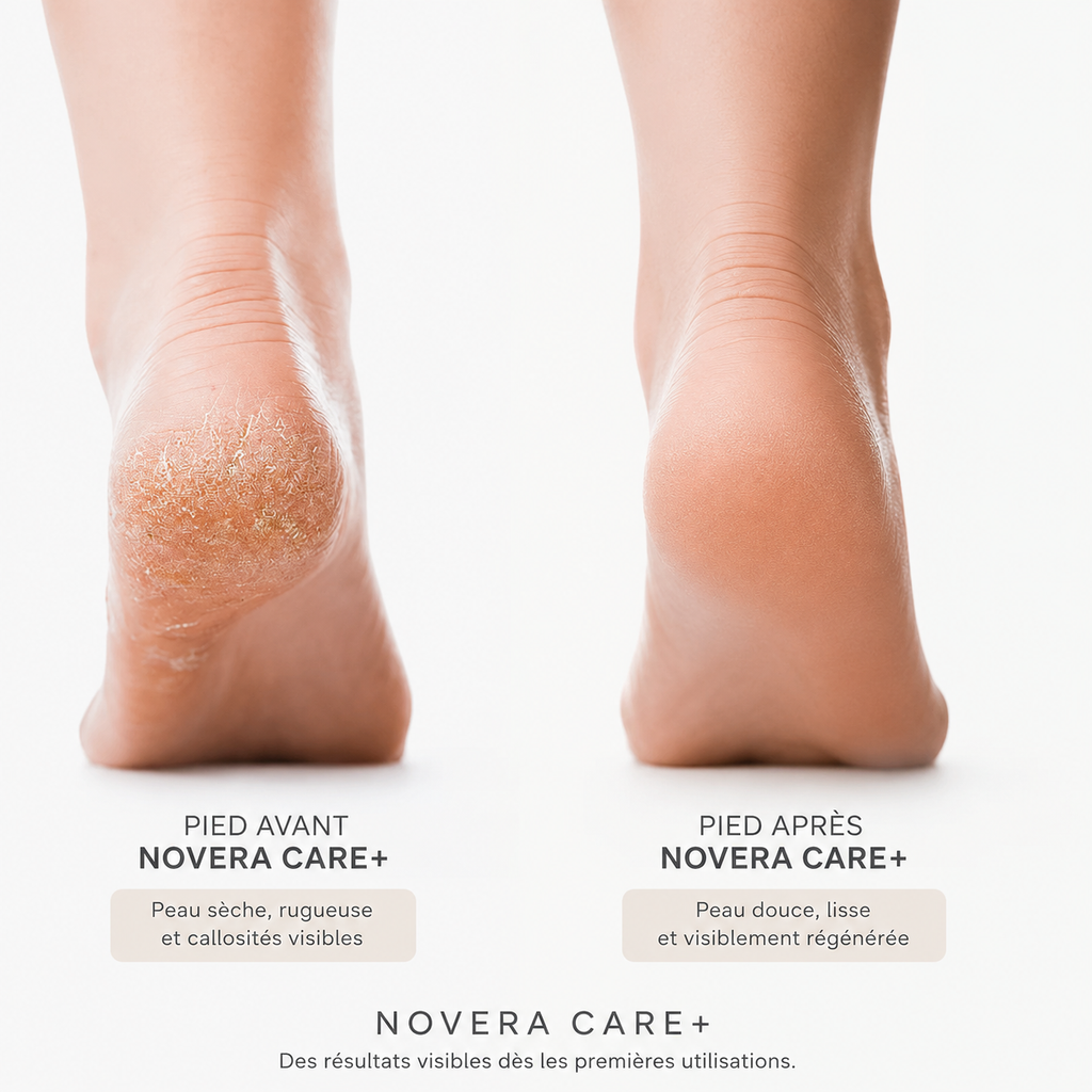 Novera Care+